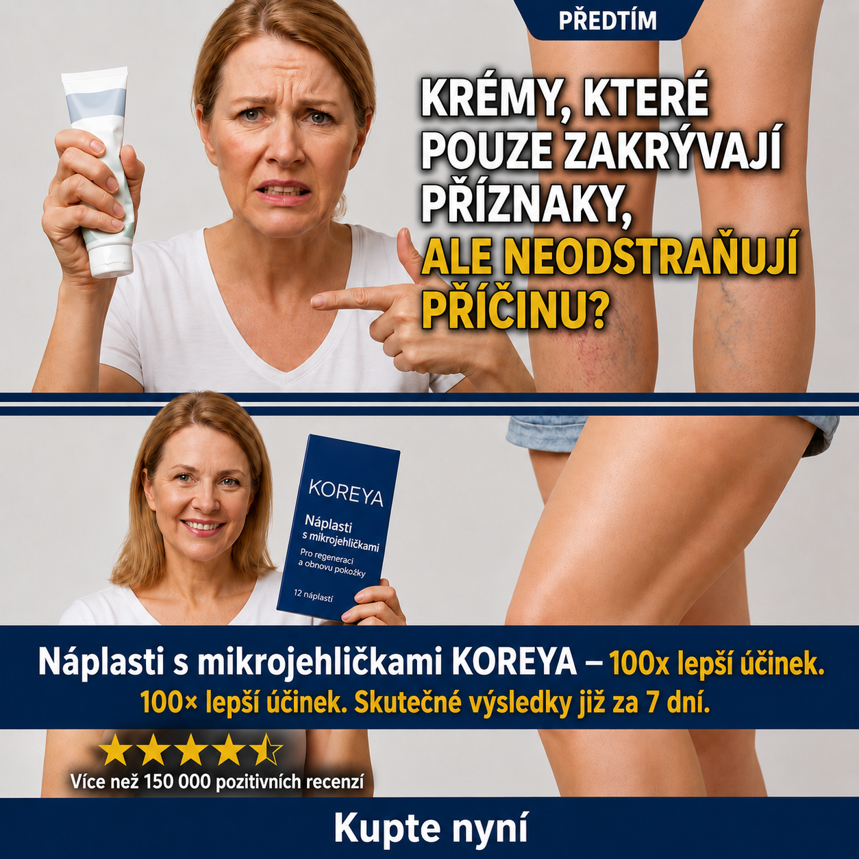 Breakix® VeinTarget náplasti s mikrojehličkami